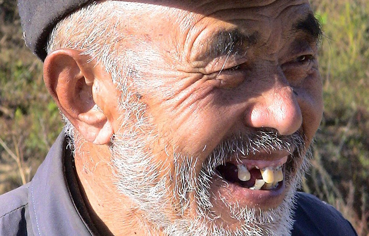 uzębienie zęby starszy mężczyzna śmieje się brakujący ząb
