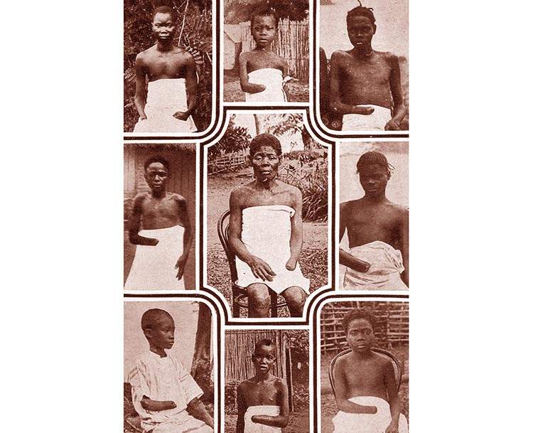 Kongo ludzie z obciętymi rękami